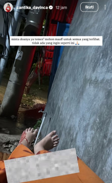 Penyanyi Cantika Davinca unggah kronologis kecelakaan yang dialaminya. [Instagram]